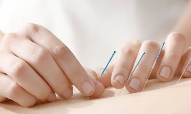 Conheça algumas doenças que podem ser tratadas com acupuntura