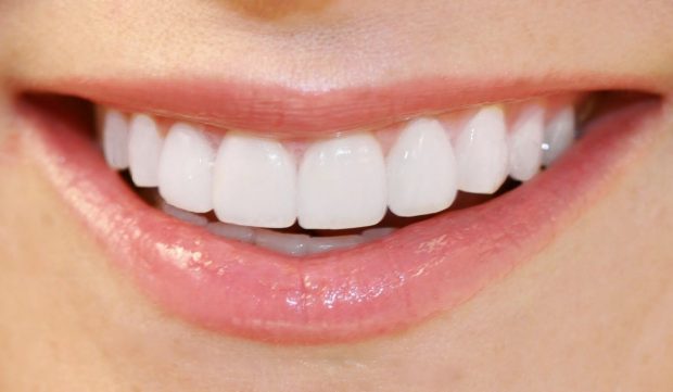 É preciso ter cuidados na hora de fazer clareamento dental – confira!